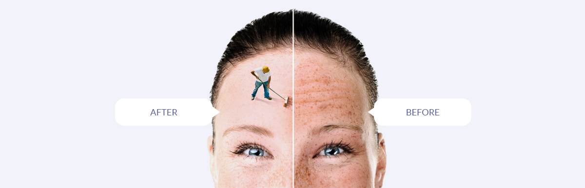 The Menkes Clinic and Surgery Center, Before & After Modal Image