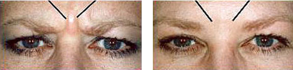 Dr. Menkes Andrew, NMD, at Menkes Clinic & Surgery Center BOTOX® / Dysport® / Xeomin® Image 01