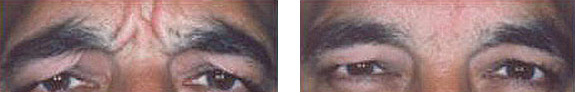 Dr. Menkes Andrew, NMD, at Menkes Clinic & Surgery Center BOTOX® / Dysport® / Xeomin® Image 03