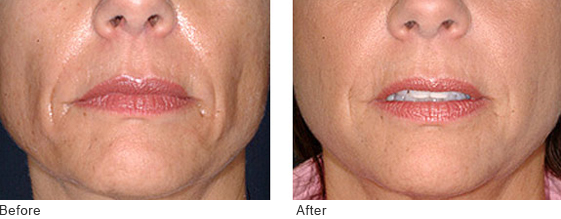 Dermatologist Mountain View - Photo Gallery 01