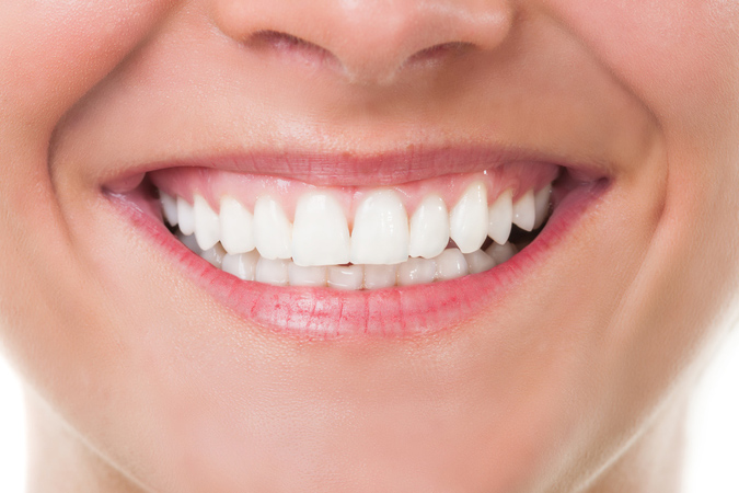 Dublin, CA area offers orthodontic treatment with Six Month Smiles