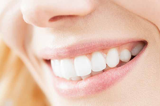 Advantages of Six Month Smiles vs. Traditional Braces in Dublin, CA dental practice