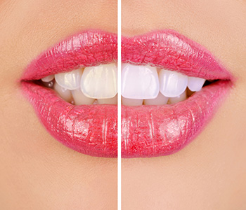 Technology Improved Cosmetic Dentistry for Cosmetic Dentists in Knoxville
