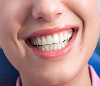Protect Teeth with Dental Crowns