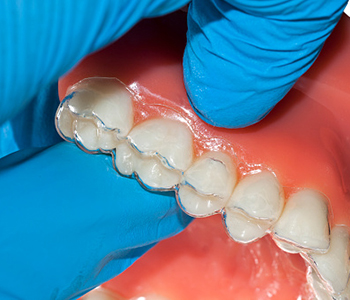 Orthodontist Knoxville