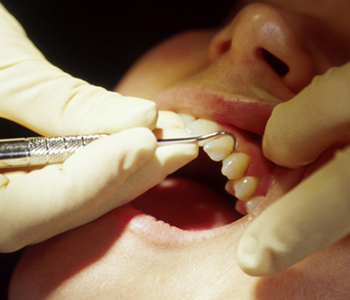 A Dentist checking patient teeth