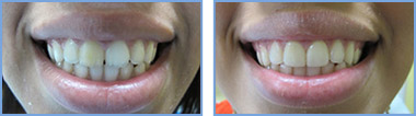 <?php echo $pk;?> - Before After 01
