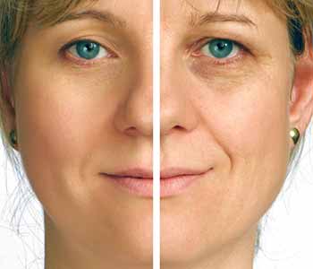Man during botox cosmetic procedure
