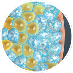 Fat Freezing Cross Section