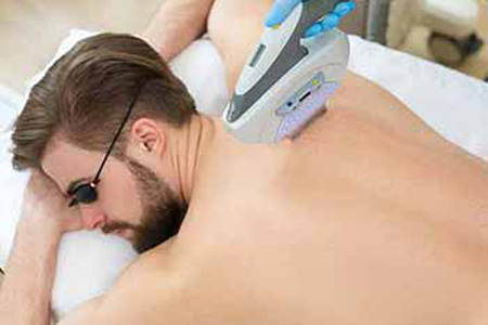 What defines good laser hair removal treatment in Bend, OR?