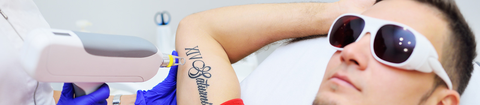 Laser Tattoo Removal