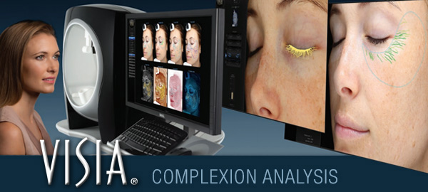 VISIA Complexion Analysis