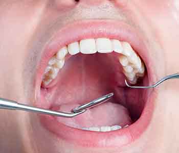 Your Cosmetic Dentist in Moonee Ponds can help you improve your smile