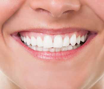 Woodbridge, On Area Dentist Describes The Benefits Of Teeth Whitening