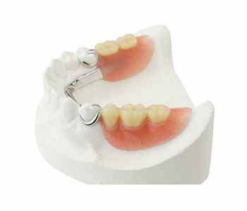Woodbridge dentist describes the purpose of partial dentures