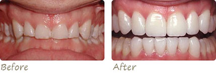 Smile Gallery Aliso Viejo - Smile Gallery Image 01