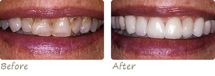 Smile Gallery Aliso Viejo - Smile Gallery Image 03