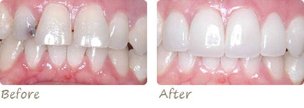 Smile Gallery Aliso Viejo - Smile Gallery Image 04