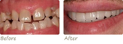 Smile Gallery Aliso Viejo - Smile Gallery Image 05
