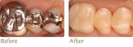 Smile Gallery Aliso Viejo - Smile Gallery Image 07