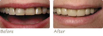 Smile Gallery Aliso Viejo - Smile Gallery Image 08