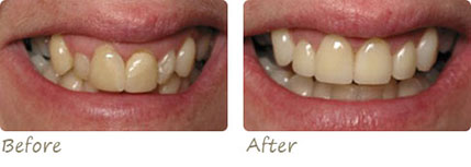 Smile Gallery Aliso Viejo - Smile Gallery Image 09