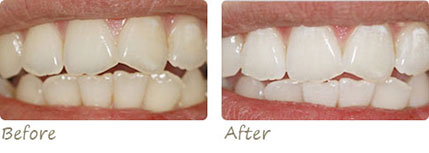 Smile Gallery Aliso Viejo - Smile Gallery Image 10