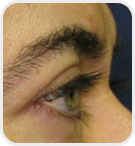 Dermatologist Rancho Cucamonga - After Image 02