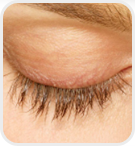 Dermatologist Rancho Cucamonga - After Image 01