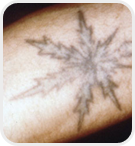 Dermatologist Rancho Cucamonga - Before Image 05