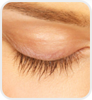 Dermatologist Rancho Cucamonga - Before Image 01