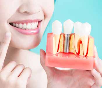 Girl showing Dental Implant structure