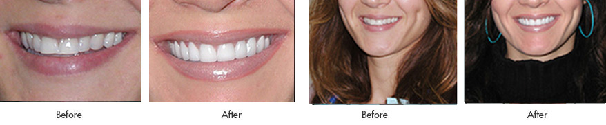 Before after Cosmetic Treatments