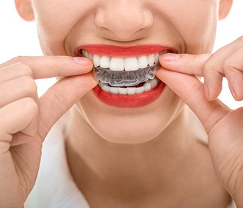 How does the cost of Invisalign® Compare to Braces?