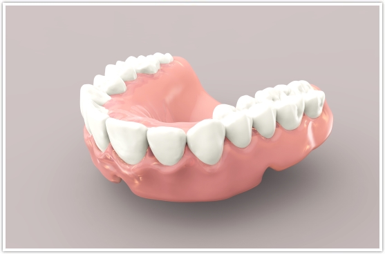 Teeth Braces