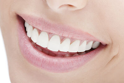 <?php echo $pk;?> - Teeth Whitening Special