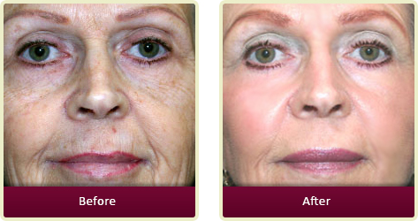 Dermatologist Fountain Valley - Home Gallery Thumb 03