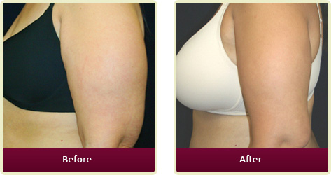 Dermatologist Fountain Valley - Home Gallery Thumb 04