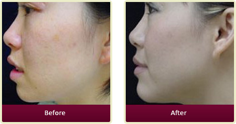 Dermatologist Fountain Valley - Home Gallery Thumb 05