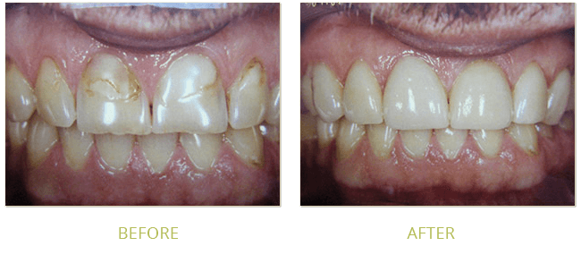 Smile Gallery Before After 05