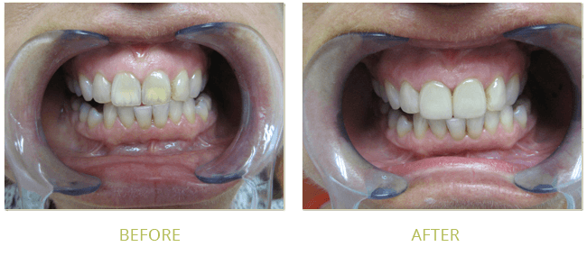 Smile Gallery Before After 07