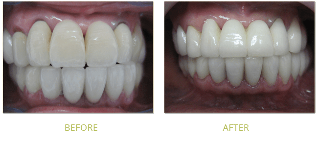 Smile Gallery Before After 09