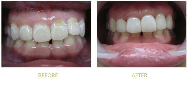 Smile Gallery Before After 03