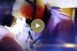 ITV Documentary: What is in your mouth? Video