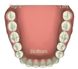 Interactive Meridian Tooth Chart App - Teeth Set