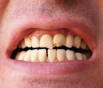 Cosmetic dental clinics like the office of Dr. Tong in Central Hong Kong repair teeth beautifully