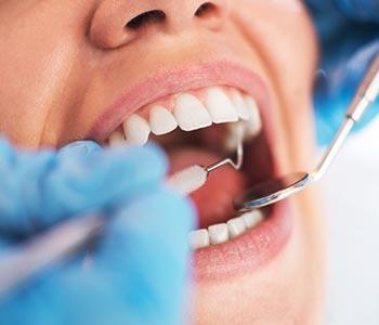 gum contouring procedure from Dentist in Central HK