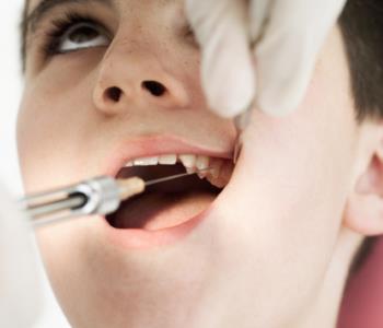 All stages of gum disease treatment from Dentist in Central HK