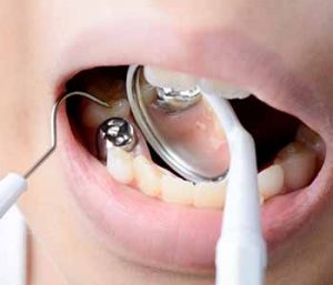 Dr. Tong Titania explains Why mercury testing is important.