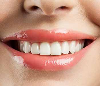 image of nice smile with bright teeth